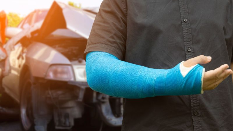 The 5 most common injuries sustained in car accidents